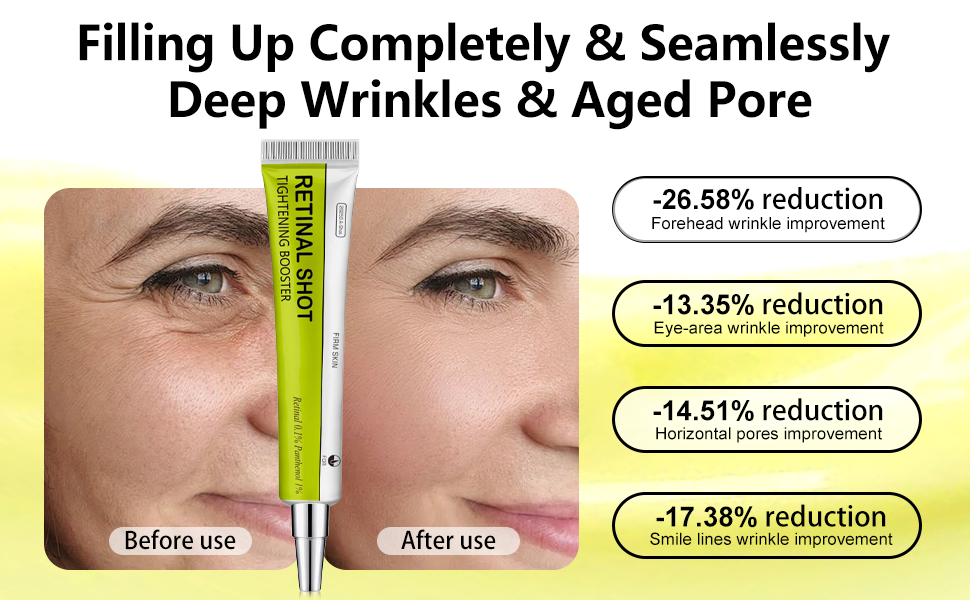 Retinal Shot Skin Tightening  ريتنال شوت لشد البشرة